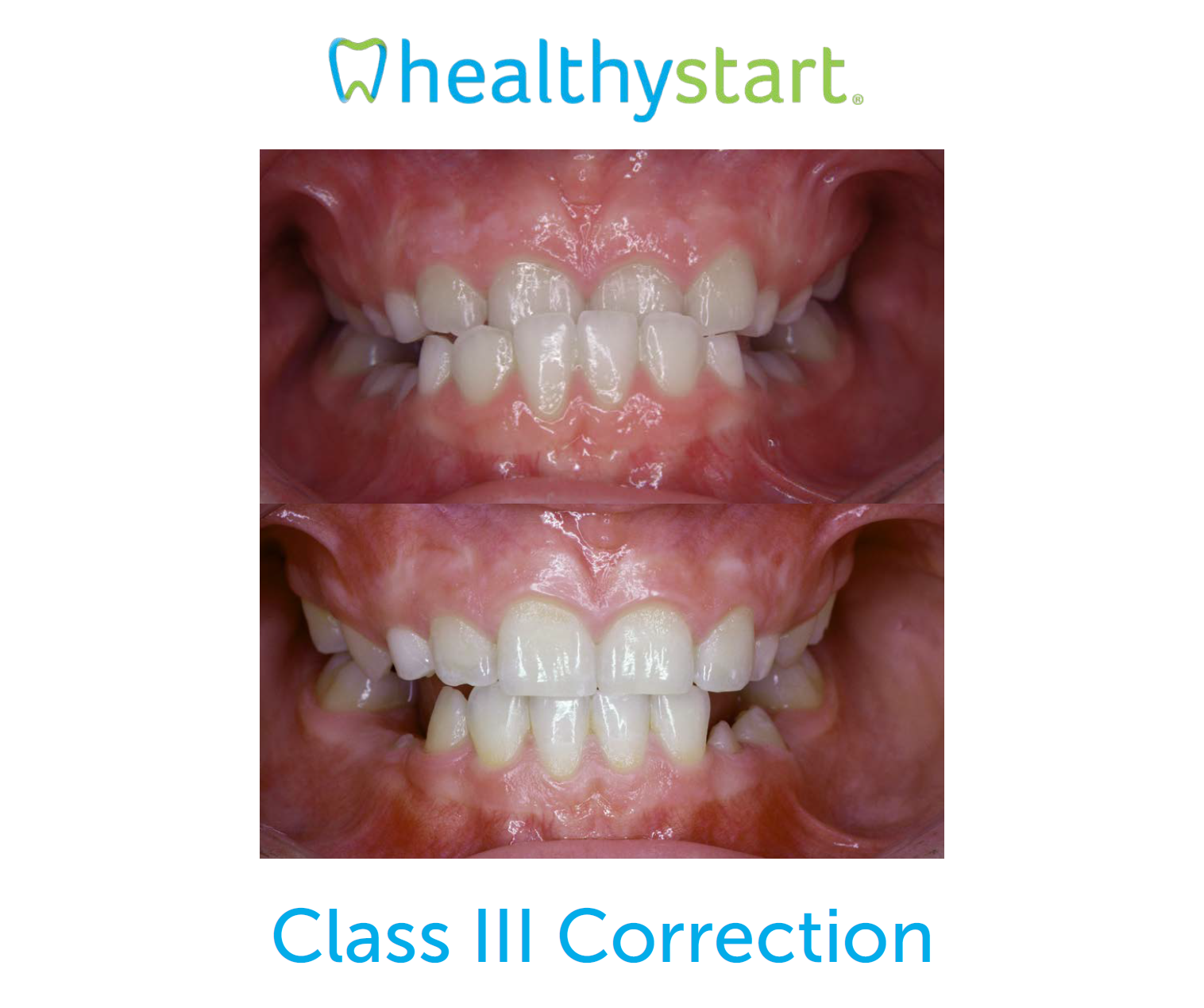 class-3-correction