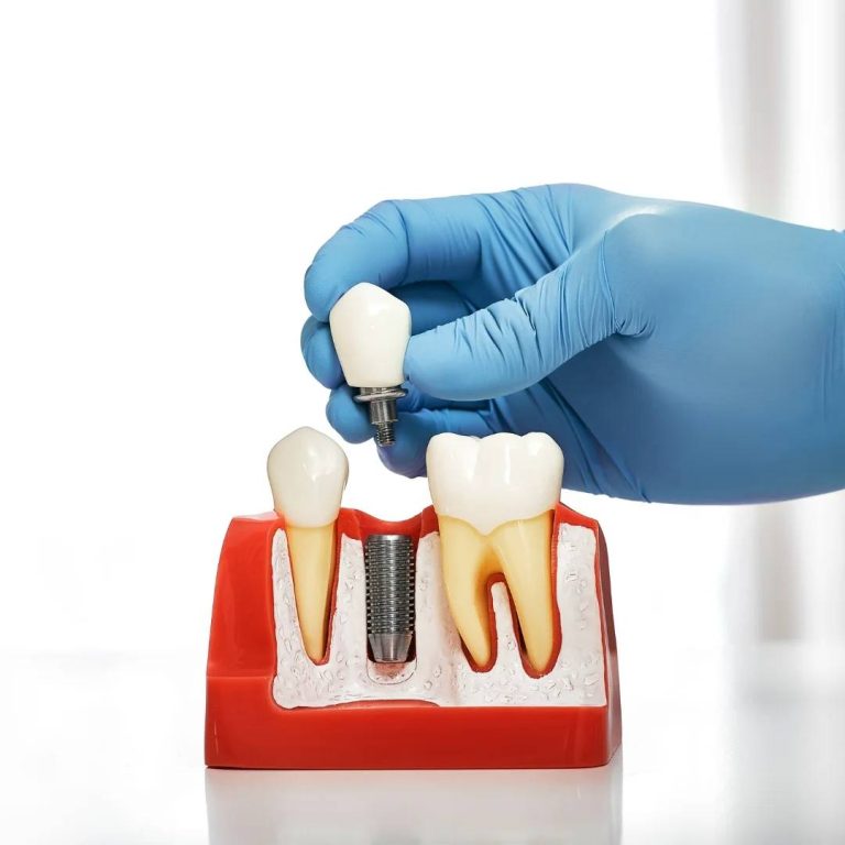 Restorative Dentistry in Komoka, ON